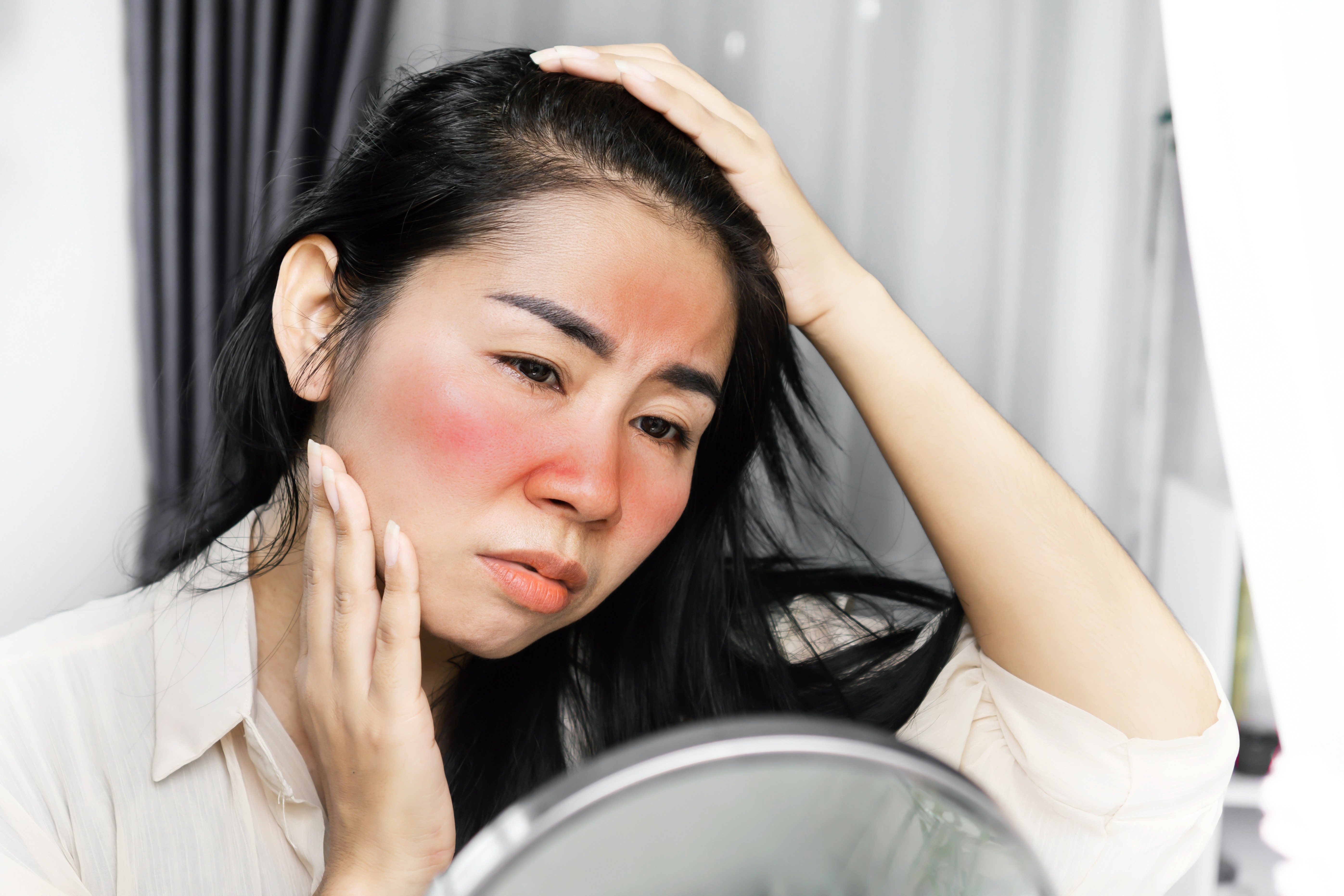 yanzhengxingpifuxing_5586x3724